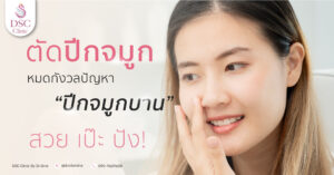 ปีกจมูกบานต้องแก้ด้วยวิธีตัดปีกจมูก