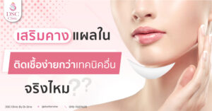ไขข้อสงสัยเสริมคางแผลในติดเชื้อง่ายกว่าจริงหรือไม่
