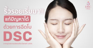ย้อนวัยด้วยฉีดโบลดริ้วรอย
