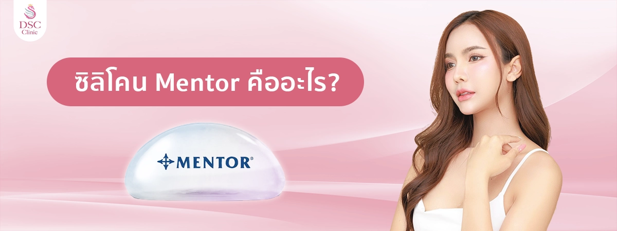 ซิลิโคน Mentor คืออะไร
